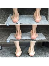 ビオプラス 広尾本店(bioplus)/3ヶ月の変化