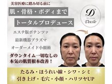 ネイルアンドアンチエイジングドゥシール(Docile)