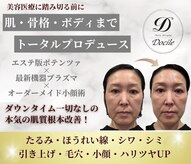 ネイルアンドアンチエイジングドゥシール(Docile)