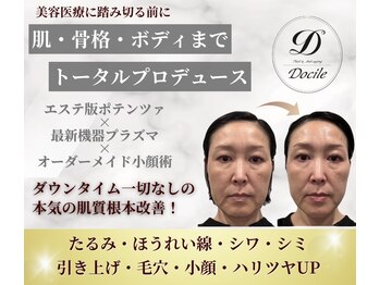 ネイルアンドアンチエイジングドゥシール(Docile)