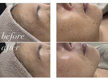 サロン ビュー(salon view)/ダクトピール/ビフォーアフター