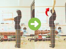 サプライズ整体院/20代ママさんの肩こり初回結果