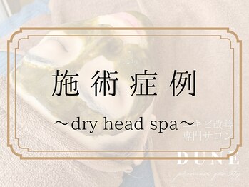 デューン 蕨店(Dune)/施術症例～ドライヘッドスパ～