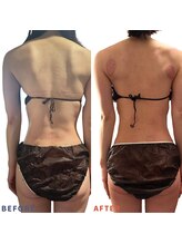 ベリップ 横浜店(Berip)/肩こり改善