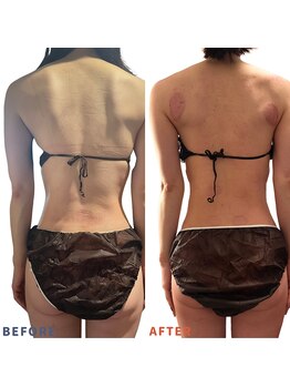 ベリップ 横浜店(Berip)/肩こり改善