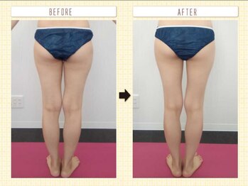 エステアンドトレーニング ビビ(ViVi)/下半身