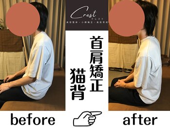クレスト(CREST)/ビフォーアフター【小顔名古屋】