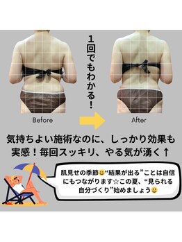 スターポルト(Star-Porte)の写真/溜まったお疲れ・老廃物をフルデトックス！頑張る自分へのご褒美に、身体の中から大掃除しましょう