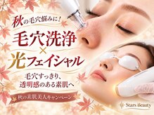 スターズ(Stars)
