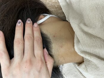 ナノハナ/鹿沼市全身脱毛美容室ナノハナ