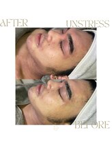 ネス 沖縄店(Nes.)/UNSTRESS/アンスレス