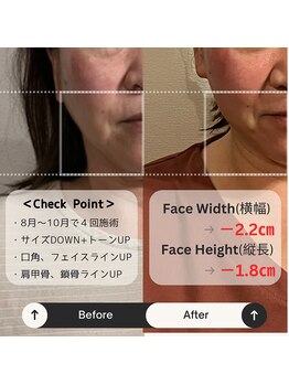 ブルハ(Bruja)/小顔矯正『コルギ』