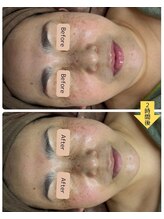 ラブニール 恵比寿店/【ワックス＆ハイドロ】