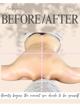 エイエービジュー(Aa.bijou)/