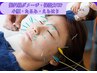【夏限定☆】美容鍼＋フェイシャル＆ひんやり保湿パック（15分）小顔/むくみ
