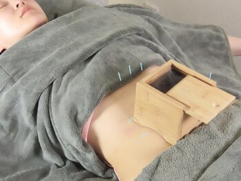 白記漢方堂鍼灸院(HAKU KI)/へそ灸