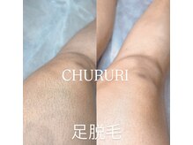 チュルリ 新町店(Chururi)/足ワックス脱毛