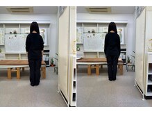 カイロプラクティック輝/姿勢の変化（女性）
