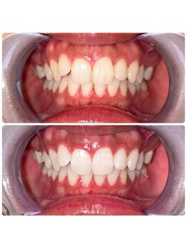 コナホワイトニング 神保町/ホワイトニング神保町