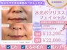 一押し【水光ボツリヌスフェイシャル¥13200】最新韓国美療で驚きのシワ改善！