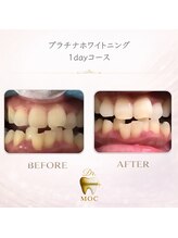 ドクターモック(Dr.MOC)/