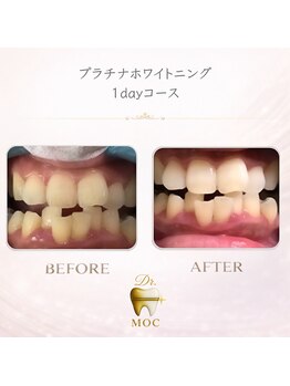 ドクターモック(Dr.MOC)/
