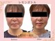 フルーア(FULUA)の写真