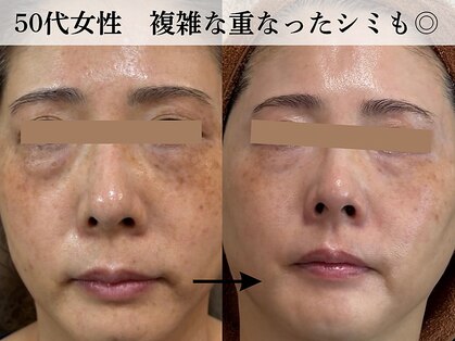 ジューンブライド(June Bride 61)の写真