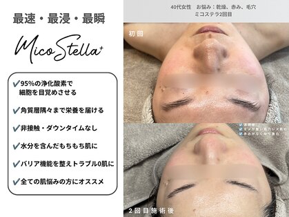 看護師監修サロン cocofleur 三軒茶屋【チタニウム/ピーリング/毛穴/小顔】の写真