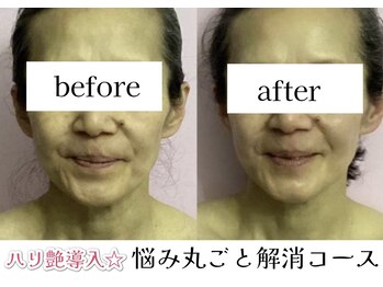 ヒトハナ(hitohana)/お顔もデコルテもツヤツヤに♪