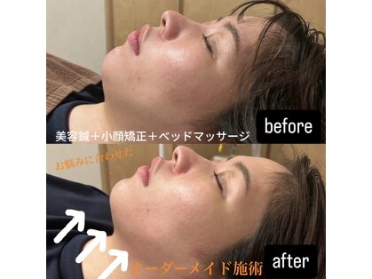 サルース(Salus)の写真