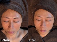 ボヌールデソワ(Bonheur de Soi)/ハーブピーリング/透明感/北堀江