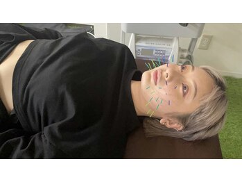 ハリトマト 梅田中崎/施術(むくみ・肌質)