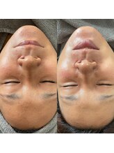 アイティス(Salon Its)/【Before &After】