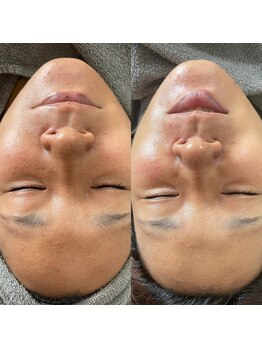 アイティス(Salon Its)/【Before &After】