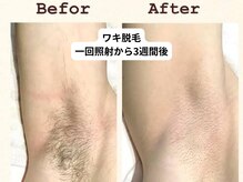 ノア(NOA.)の雰囲気（秋冬脱毛キャンペーン★結果に自信！信頼の完全都度払いサロン）