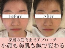 ミリグラム(mg)の雰囲気（＼体の内側ケアで美しくなる／お肌も身体も回復力が断然変わる♪）