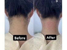 チル(Chill)/【うなじWAX】後ろ姿美人！