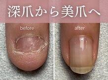 トレフル(Trefle)