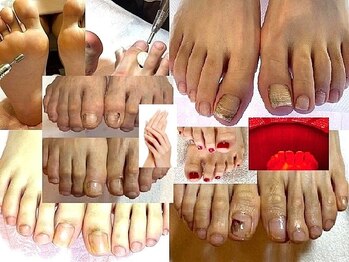 ビサンテ サロンの写真/《足自爪ケア/+角質ケア/+自爪育成,爪保護コーティング/角質育成ケア[足裏肌質改善],FootGel,手ケア》人気!