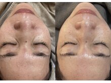 ビーマジック(Be Magic)/