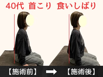 パルマ なかもず(Palma)/整体/頭痛/肩こり/ヘッドスパ