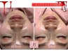 レッドショッレッドショッレッドショッレッドショット｜このクーポン予約不可