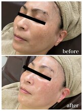 ジャスミン(Jasmin)/エステティック×シェービング