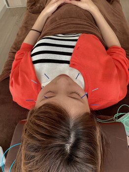 ハリファ鍼灸院 横浜関内院(HariFa鍼灸院)/美容施術