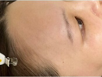 ナビ(nabi)の写真/フェイスワックスで美しいお顔に♪定期的なお手入れで肌質改善が見込めます！（鎮静パック付）