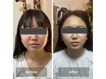 リノリー 古川店(rinory)/人気No. 1〈小顔矯正〉