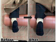 すまいむ整体院/下肢のお悩み