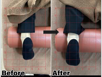 すまいむ整体院/下肢のお悩み