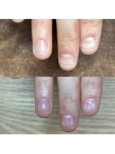 リリ(lili)/自爪育成＋クリアジェル